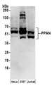 PPAN Antibody - Detection of human PPAN by western blot. Samples: Whole cell lysate (50 µg) from HeLa, HEK293T, and Jurkat cells prepared using NETN lysis buffer. Antibodies: Affinity purified rabbit anti-PPAN antibody used for WB at 0.1 µg/ml. Detection: Chemiluminescence with an exposure time of 3 minutes.