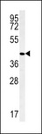 PPAN Antibody - PPAN Antibody western blot of ZR-75-1 cell line lysates (35 ug/lane). The PPAN antibody detected the PPAN protein (arrow).