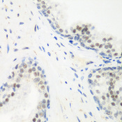PPAN Antibody - Immunohistochemistry of paraffin-embedded human prostate.