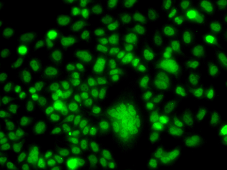 PPAN Antibody - Immunofluorescence analysis of A549 cells.
