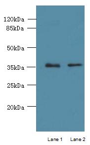 PPAP2C Antibody - Western blot. All lanes: PPAP2C antibody at 8 ug/ml. Lane 1: A549 whole cell lysate. Lane 2: MCF7 whole cell lysate. Secondary Goat polyclonal to Rabbit IgG at 1:10000 dilution. Predicted band size: 33 kDa. Observed band size: 33 kDa.