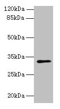 PPAP2C Antibody - Western blot All lanes: PPAP2C antibody at 8µg/ml Lane 1: A549 whole cell lysate Lane 2: MCF-7 whole cell lysate Secondary Goat polyclonal to rabbit IgG at 1/10000 dilution Predicted band size: 33, 35, 27 kDa Observed band size: 33 kDa