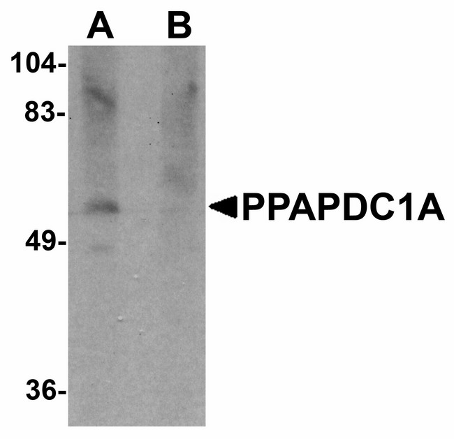 PPAPDC1A / DPPL2 Antibody - Western blot of PPAPDC1A in human brain tissue lysate with PPAPDC1A antibody at 1 ug/ml in (A) the absence and (B) the presence of blocking peptide.