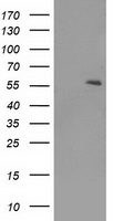 PPARA / PPAR Alpha Antibody - HEK293T cells were transfected with the pCMV6-ENTRY control (Left lane) or pCMV6-ENTRY PPARA (Right lane) cDNA for 48 hrs and lysed. Equivalent amounts of cell lysates (5 ug per lane) were separated by SDS-PAGE and immunoblotted with anti-PPARA.