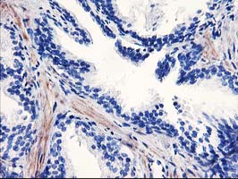 PPARA / PPAR Alpha Antibody - IHC of paraffin-embedded Human prostate tissue using anti-PPARA mouse monoclonal antibody. (Heat-induced epitope retrieval by 10mM citric buffer, pH6.0, 100C for 10min).