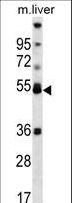 PPARA / PPAR Alpha Antibody - PPARA Antibody western blot of mouse liver tissue lysates (35 ug/lane). The PPARA antibody detected the PPARA protein (arrow).