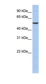 PPARA / PPAR Alpha Antibody - PPARA / PPAR antibody Western blot of HeLa lysate. This image was taken for the unconjugated form of this product. Other forms have not been tested.