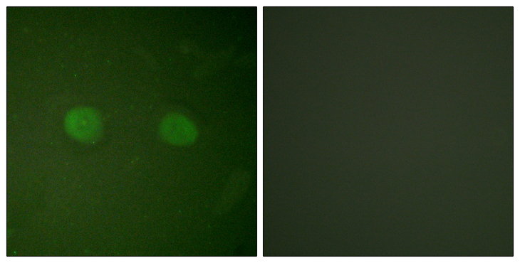 PPARA / PPAR Alpha Antibody - Immunofluorescence analysis of HeLa cells, using PPAR-alpha Antibody. The picture on the right is blocked with the synthesized peptide.