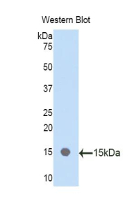 PPARA / PPAR Alpha Antibody - Western blot of recombinant PPAR Alpha.  This image was taken for the unconjugated form of this product. Other forms have not been tested.