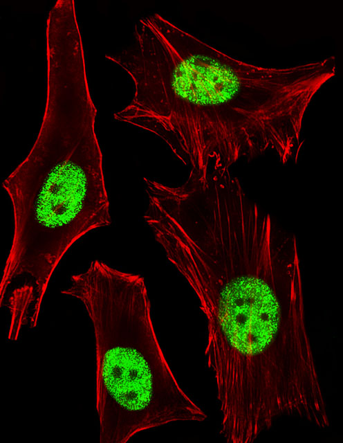 PPARA / PPAR Alpha Antibody - Fluorescent image of HeLa cells stained with PPARA Antibody. Antibody was diluted at 1:25 dilution. An Alexa Fluor 488-conjugated goat anti-mouse lgG at 1:400 dilution was used as the secondary antibody (green). Cytoplasmic actin was counterstained with Alexa Fluor 555 conjugated with Phalloidin (red).