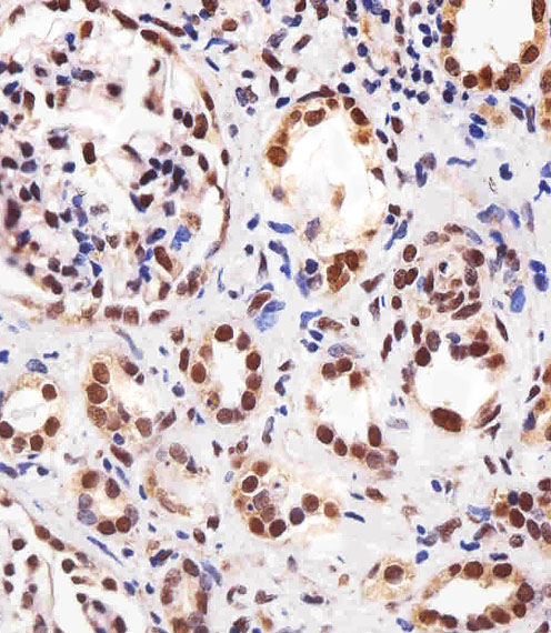 PPARA / PPAR Alpha Antibody - Immunohistochemical of paraffin-embedded H. kidney section using PPARA Antibody. Antibody was diluted at 1:25 dilution. A peroxidase-conjugated goat anti-rabbit IgG at 1:400 dilution was used as the secondary antibody, followed by DAB staining.