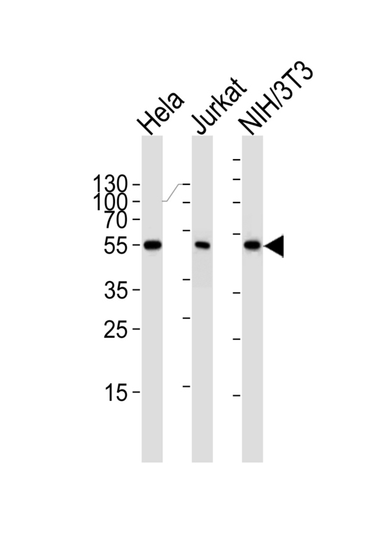 PPARA / PPAR Alpha Antibody - Western blot of lysates from HeLa, Jurkat, mouse NIH/3T3 cell line (from left to right) with PPARA Antibody. Antibody was diluted at 1:1000 at each lane. A goat anti-mouse IgG H&L (HRP) at 1:3000 dilution was used as the secondary antibody. Lysates at 35 ug per lane.