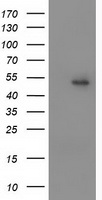PPARA / PPAR Alpha Antibody - HEK293T cells were transfected with the pCMV6-ENTRY control (Left lane) or pCMV6-ENTRY PPARA (Right lane) cDNA for 48 hrs and lysed. Equivalent amounts of cell lysates (5 ug per lane) were separated by SDS-PAGE and immunoblotted with anti-PPARA.