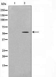 PPARA / PPAR Alpha Antibody - Western blot analysis of PPAR-alpha expression in NIH 3T3 cells extracts. The lane on the left is treated with the antigen-specific peptide.