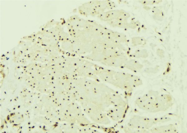 PPARA / PPAR Alpha Antibody - 1:100 staining mouse muscle tissue by IHC-P. The sample was formaldehyde fixed and a heat mediated antigen retrieval step in citrate buffer was performed. The sample was then blocked and incubated with the antibody for 1.5 hours at 22°C. An HRP conjugated goat anti-rabbit antibody was used as the secondary.