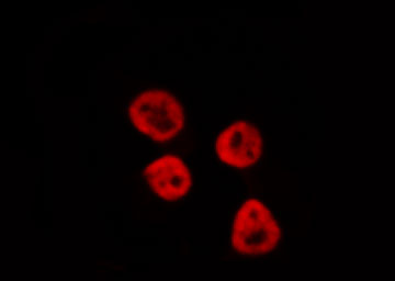 PPARA / PPAR Alpha Antibody - Staining HeLa cells by IF/ICC. The samples were fixed with PFA and permeabilized in 0.1% Triton X-100, then blocked in 10% serum for 45 min at 25°C. The primary antibody was diluted at 1:200 and incubated with the sample for 1 hour at 37°C. An Alexa Fluor 594 conjugated goat anti-rabbit IgG (H+L) antibody, diluted at 1/600, was used as secondary antibody.