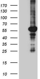 PPARD / PPAR Delta Antibody - HEK293T cells were transfected with the pCMV6-ENTRY control. (Left lane) or pCMV6-ENTRY PPARD. (Right lane) cDNA for 48 hrs and lysed
