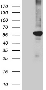 PPARD / PPAR Delta Antibody - HEK293T cells were transfected with the pCMV6-ENTRY control. (Left lane) or pCMV6-ENTRY PPARD. (Right lane) cDNA for 48 hrs and lysed. Equivalent amounts of cell lysates. (5 ug per lane) were separated by SDS-PAGE and immunoblotted with anti-PPARD. (1:2000)