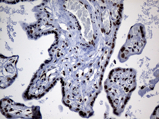 PPARD / PPAR Delta Antibody - Immunohistochemical staining of paraffin-embedded Human placenta tissue within the normal limits using anti-PPARD mouse monoclonal antibody. (Heat-induced epitope retrieval by 1mM EDTA in 10mM Tris buffer. (pH8.5) at 120 oC for 3 min. (1:150)