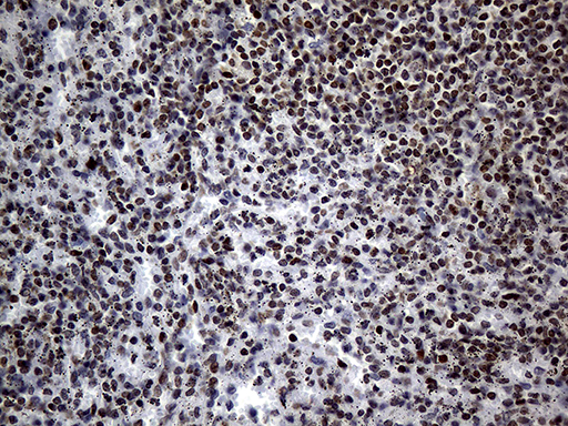 PPARD / PPAR Delta Antibody - Immunohistochemical staining of paraffin-embedded Human spleen tissue within the normal limits using anti-PPARD mouse monoclonal antibody. (Heat-induced epitope retrieval by Tris-EDTA(1:150)