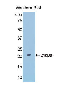 PPARD / PPAR Delta Antibody - Western blot of PPARD / PPAR Delta antibody.