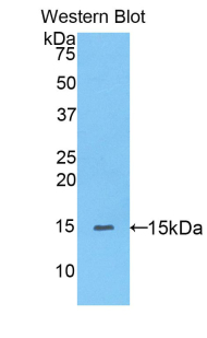 PPARD / PPAR Delta Antibody - Western blot of recombinant PPARD / PPAR Delta.  This image was taken for the unconjugated form of this product. Other forms have not been tested.