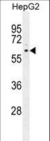 PPARD / PPAR Delta Antibody - PPARD Antibody western blot of HepG2 cell line lysates (35 ug/lane). The PPARD antibody detected the PPARD protein (arrow).