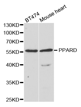 PPARD / PPAR Delta Antibody - Western blot analysis of extracts of various cell lines.