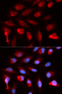 PPARD / PPAR Delta Antibody - Immunofluorescence analysis of U20S cells.