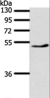 PPARD / PPAR Delta Antibody - Western blot analysis of Mouse heart tissue, using PPARD Polyclonal Antibody at dilution of 1:500.