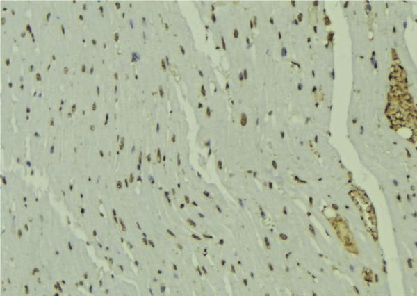 PPARD / PPAR Delta Antibody - 1:100 staining mouse muscle tissue by IHC-P. The sample was formaldehyde fixed and a heat mediated antigen retrieval step in citrate buffer was performed. The sample was then blocked and incubated with the antibody for 1.5 hours at 22°C. An HRP conjugated goat anti-rabbit antibody was used as the secondary.