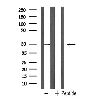PPARD / PPAR Delta Antibody - Western blot analysis of extracts of rat muscle using PPARD antibody.