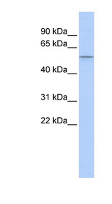 PPARD / PPAR Delta Antibody - PPARD antibody Western blot of 721_B cell lysate. This image was taken for the unconjugated form of this product. Other forms have not been tested.