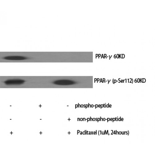 PPARG / PPAR Gamma Antibody - Western blot of Phospho-PPAR-gamma (S112) antibody