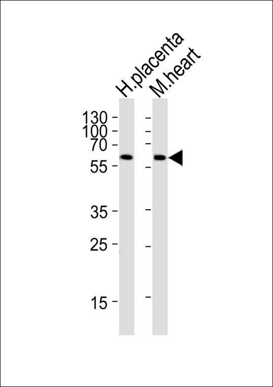 PPARG / PPAR Gamma Antibody - Western blot of lysates from human placenta and mouse heart tissue lysate (from left to right) with PPARG Antibody. Antibody was diluted at 1:1000 at each lane. A goat anti-rabbit IgG H&L (HRP) at 1:5000 dilution was used as the secondary antibody. Lysates at 35 ug per lane.