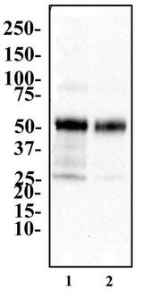 PPARG / PPAR Gamma Antibody - Western Blot: PPAR gamma Antibody - Western blot analysis of PPAR gamma in 1. human adipose and 2. human adrenal lysate.  This image was taken for the unconjugated form of this product. Other forms have not been tested.