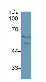 PPARG / PPAR Gamma Antibody - Western Blot; Sample: Rat Placenta lysate; Primary Ab: 1µg/ml Rabbit Anti-Rat PPARg Antibody Second Ab: 0.2µg/mL HRP-Linked Caprine Anti-Rabbit IgG Polyclonal Antibody