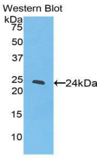 PPARG / PPAR Gamma Antibody - Western blot of recombinant PPARG / PPAR Gamma.  This image was taken for the unconjugated form of this product. Other forms have not been tested.