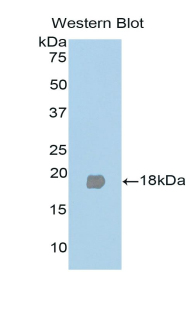 PPARG / PPAR Gamma Antibody - Western blot of recombinant PPARG / PPAR Gamma.  This image was taken for the unconjugated form of this product. Other forms have not been tested.