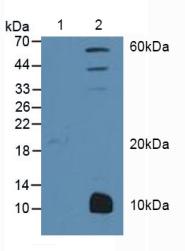 PPARG / PPAR Gamma Antibody - Western Blot; Sample: Lane1: Human MCF7 cells; Lane2: Mouse Liver Tissue.