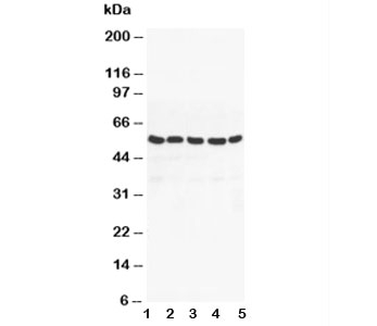 PPARG / PPAR Gamma Antibody - Western blot testing of PPAR gamma antibody and Lane 1: MM453; 2: MM231; 3: HeLa; 4: Jurkat; 5: HT1080 cell lysate