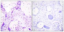 PPARG / PPAR Gamma Antibody - Immunohistochemistry analysis of paraffin-embedded human placenta tissue, using PPAR-gamma Antibody. The picture on the right is blocked with the synthesized peptide.