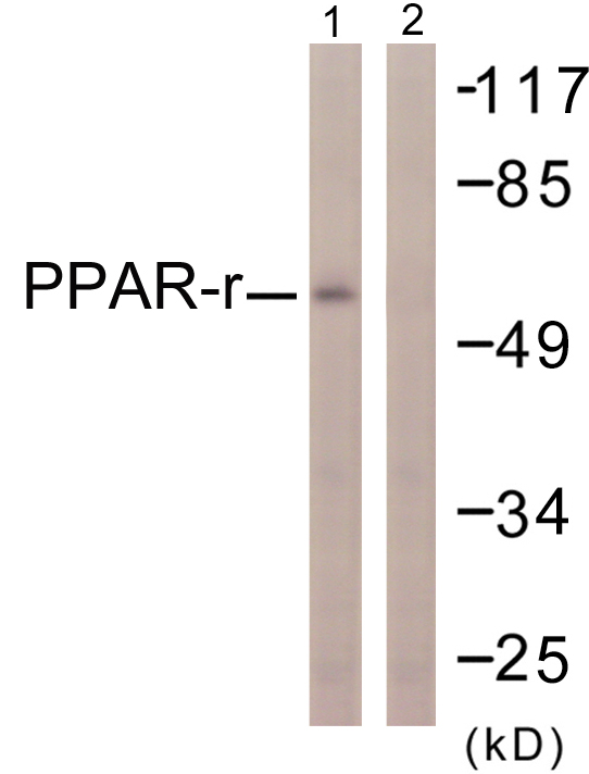 PPARG / PPAR Gamma Antibody - Western blot analysis of lysates from HUVEC cells, using PPAR-gamma Antibody. The lane on the right is blocked with the synthesized peptide.
