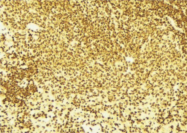 PPARG / PPAR Gamma Antibody - 1:100 staining mouse spleen tissue by IHC-P. The sample was formaldehyde fixed and a heat mediated antigen retrieval step in citrate buffer was performed. The sample was then blocked and incubated with the antibody for 1.5 hours at 22°C. An HRP conjugated goat anti-rabbit antibody was used as the secondary.