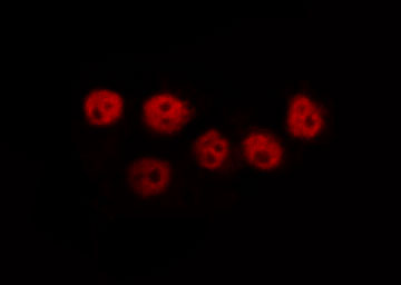 PPARG / PPAR Gamma Antibody - Staining HeLa cells by IF/ICC. The samples were fixed with PFA and permeabilized in 0.1% Triton X-100, then blocked in 10% serum for 45 min at 25°C. The primary antibody was diluted at 1:200 and incubated with the sample for 1 hour at 37°C. An Alexa Fluor 594 conjugated goat anti-rabbit IgG (H+L) Ab, diluted at 1/600, was used as the secondary antibody.
