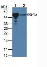 PPARG / PPAR Gamma Antibody - Western Blot; Sample: Lane1: Porcine Liver Tissue; Lane2: Porcine Heart Tissue.