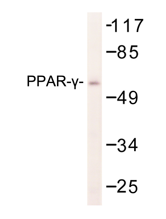 PPARG / PPAR Gamma Antibody - Western blot of PPAR- (I106) pAb in extracts from K562 cells.
