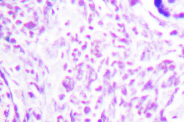PPARG / PPAR Gamma Antibody - IHC of PPAR- (I106) pAb in paraffin-embedded human placenta tissue.
