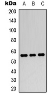 PPARG / PPAR Gamma Antibody - Western blot analysis of PPAR gamma expression in HeLa (A); MCF7 (B); mouse brain (C) whole cell lysates.