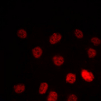 PPARG / PPAR Gamma Antibody - Immunofluorescent analysis of PPAR gamma staining in MCF7 cells. Formalin-fixed cells were permeabilized with 0.1% Triton X-100 in TBS for 5-10 minutes and blocked with 3% BSA-PBS for 30 minutes at room temperature. Cells were probed with the primary antibody in 3% BSA-PBS and incubated overnight at 4 deg C in a humidified chamber. Cells were washed with PBST and incubated with a DyLight 594-conjugated secondary antibody (red) in PBS at room temperature in the dark. DAPI was used to stain the cell nuclei (blue).